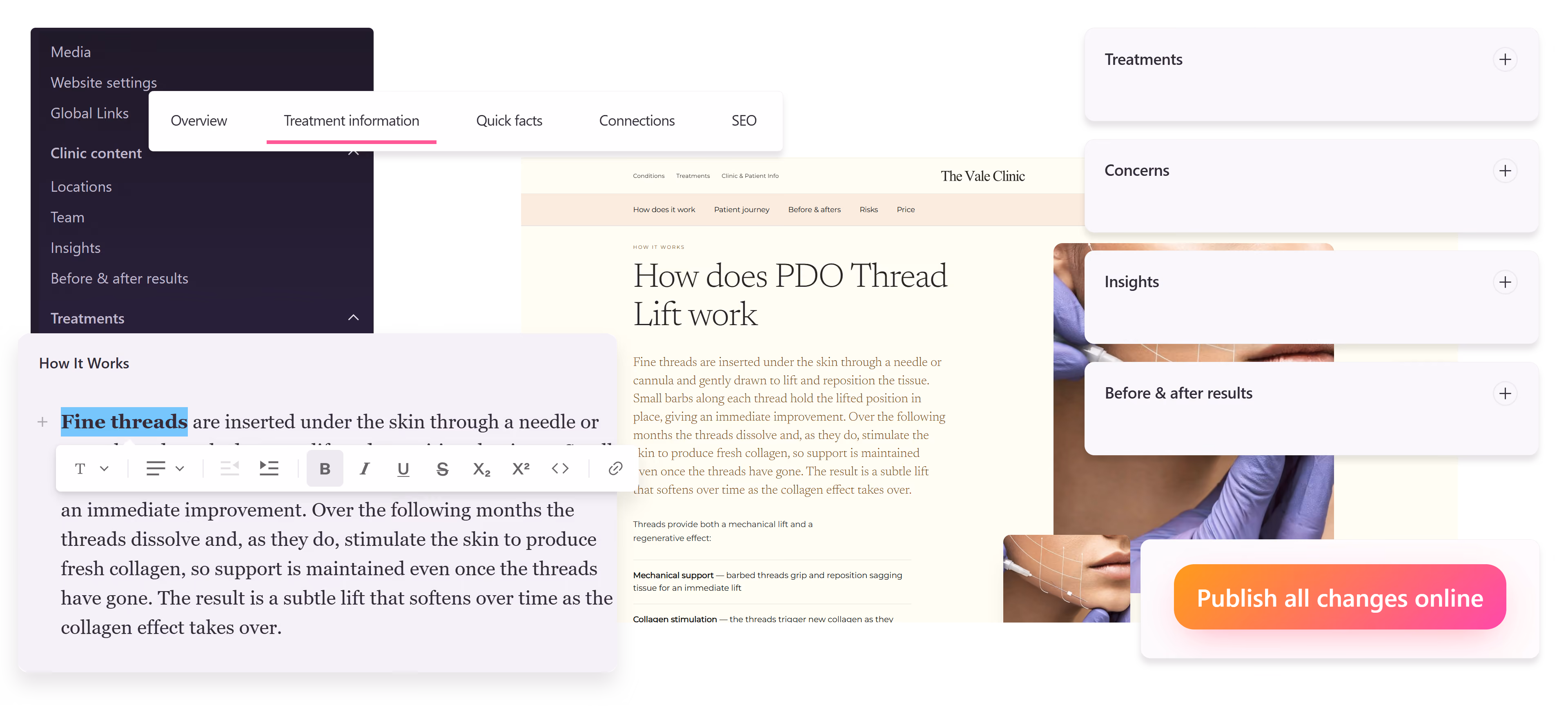 Le CMS iGlowly : édition des contenus, contenus reliés et publication